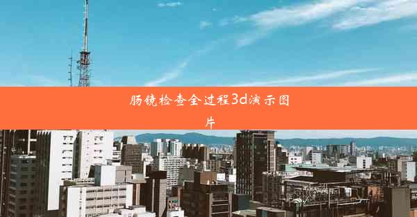 肠镜检查全过程3d演示图片